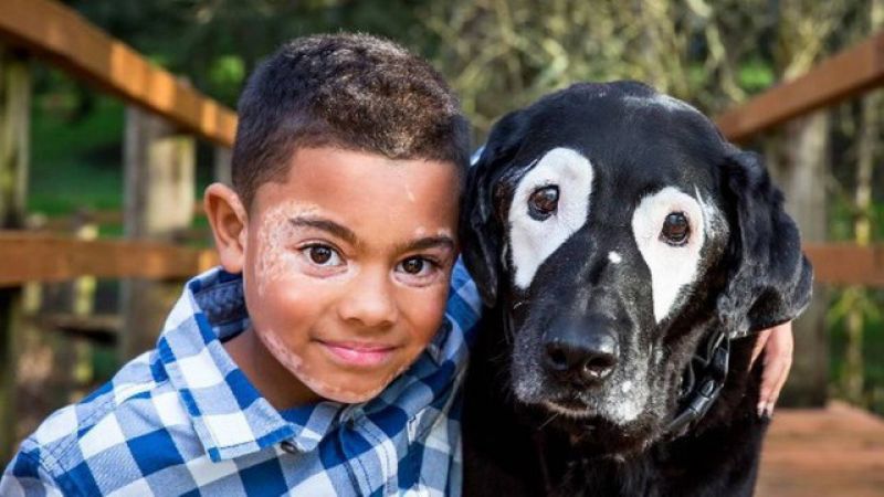 Menino com vitiligo faz amizade com cachorro que tem a mesma doença